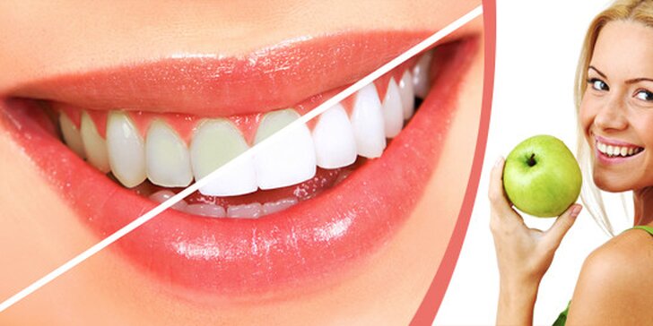 Bělení zubů neperoxidovým gelem - nová aplikace (Znojmo)