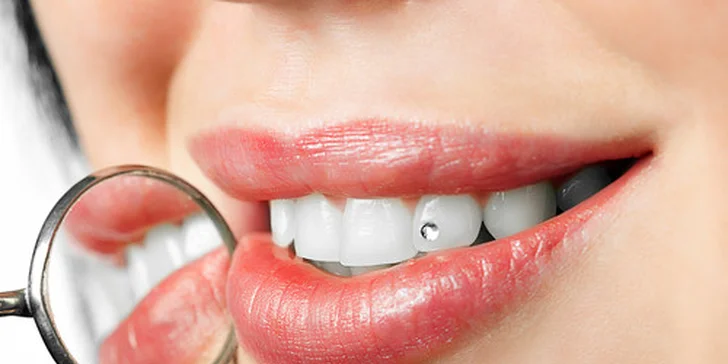 Profesionální dentální hygiena v centru Prahy