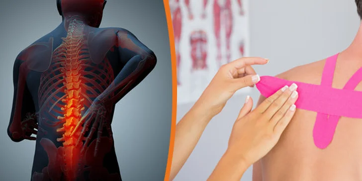 Tejping unavených svalů