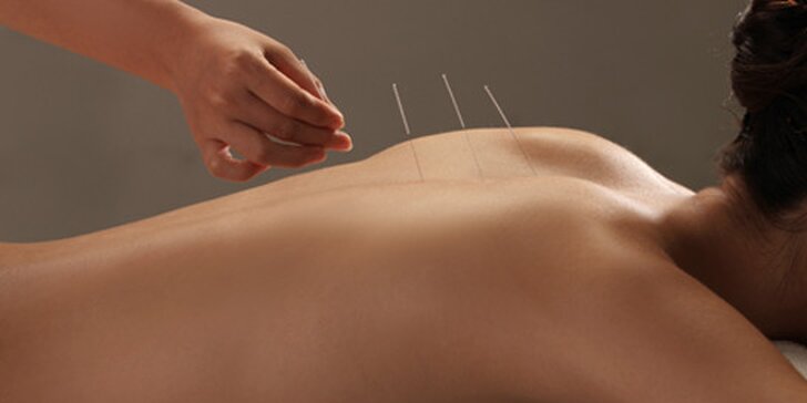 Bezbolestná akupunktura na odbourání bolesti i psychických problémů