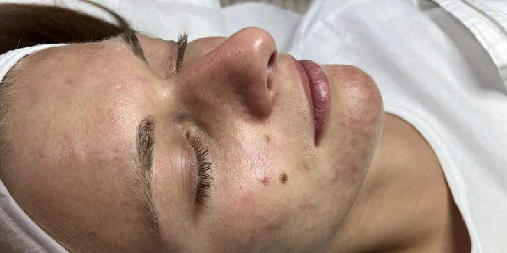 Výsledkem bude pružná a pevnější pleť s viditelným liftingovým efektem.