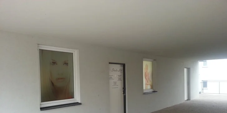 Zvětšení rtů kyselinou hyaluronovou