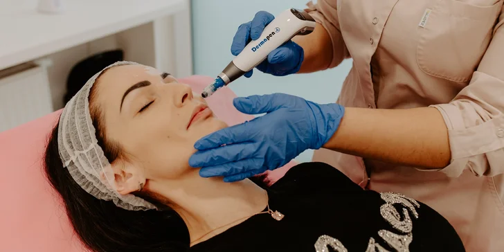 Ošetrenie lekárskym dermapenom alebo darčekový poukaz na estetické služby v hodnote 100 € a 150 €