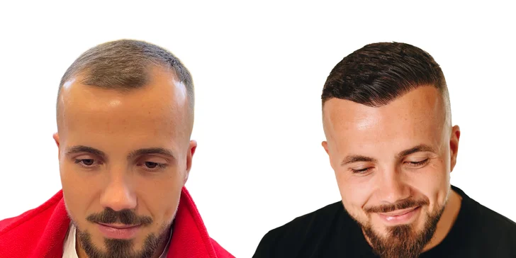 Pred a po - viac ako 16 mesiacocv