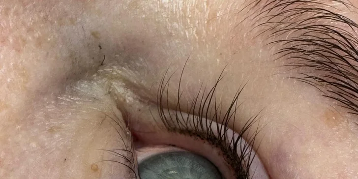 Permanentní make-up vydrží individuálně (obvykle 1–4 roky). Po dobu hojení se vyhněte bazénu, sauně a opalování. 