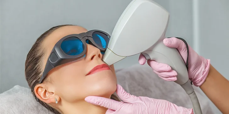 Laserová epilácia pre dámy: Horná pera, brada, podpazušie či predkolenie