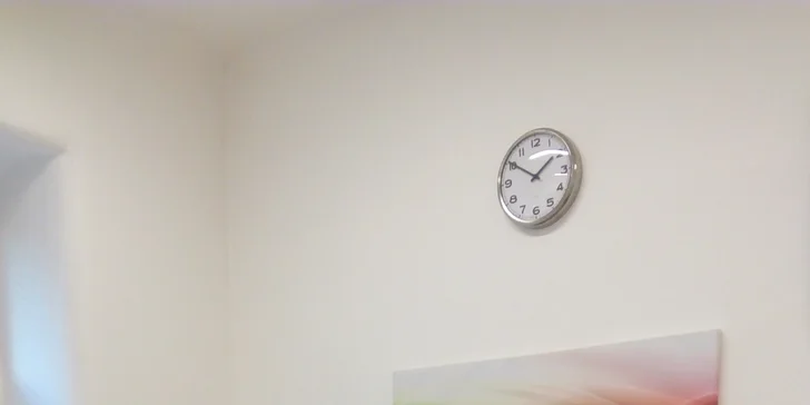 Po lokální anestezii proběhne pískování Air-flow (odstranění pigmentací).