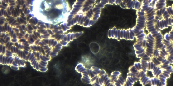Rozbor živé kapky krve v temném poli mikroskopu