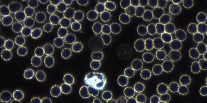 Vyšetření živé kapky krve v temném poli mikroskopu