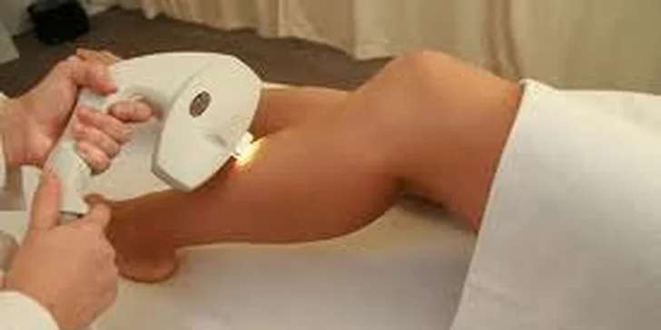 Odstranění chloupků laserem E-light