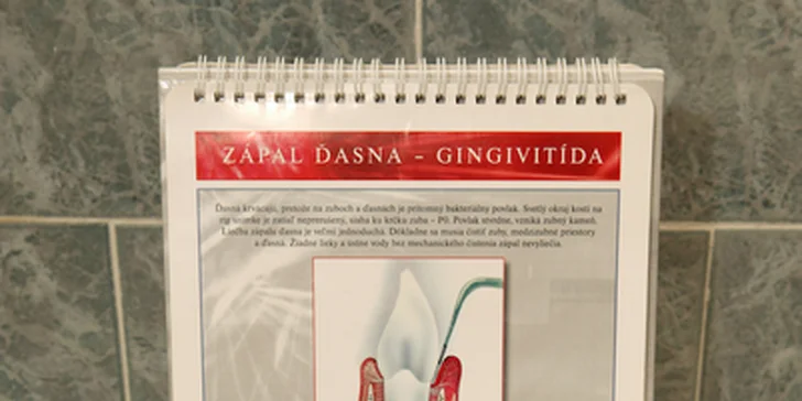 Důkladná dentální hygiena či šetrné bělení zubů