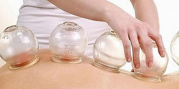 Baňková masáž – velmi učinná v délce 30 minut