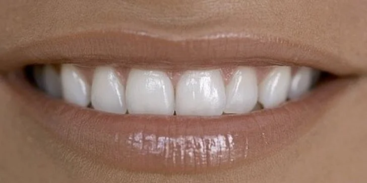 Profesionální kompletní dentální hygiena