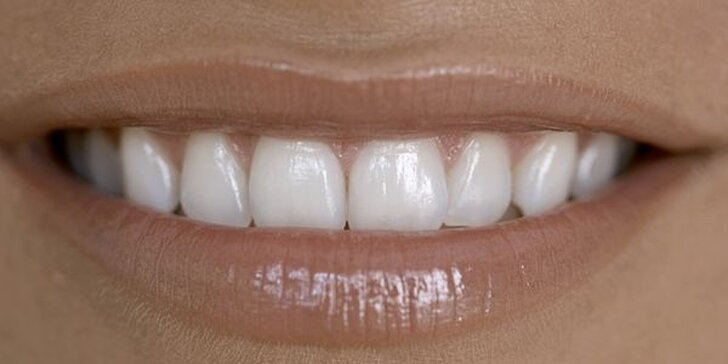 Ordinační bělení zubů a Airflow v Centru zubní péče