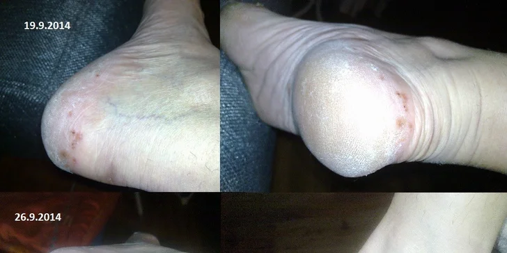 Léčivé rybičky Garra Rufa pro jednoho nebo pro páry
