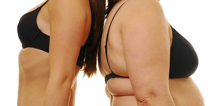 Zhuběte bezbolestně a bez diet s kryolipolýzou v centru Brna