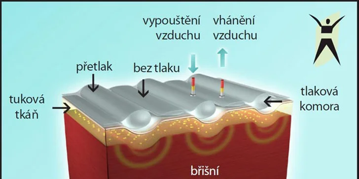 Permanentka do Expresky, cvičení Slim Belly - 6 provozoven