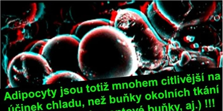 2×40 minut certifikované thermo kryolipolýzy