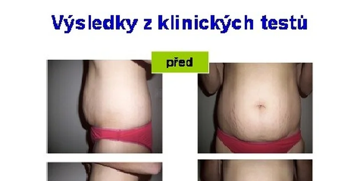 2×40 minut certifikované thermo kryolipolýzy
