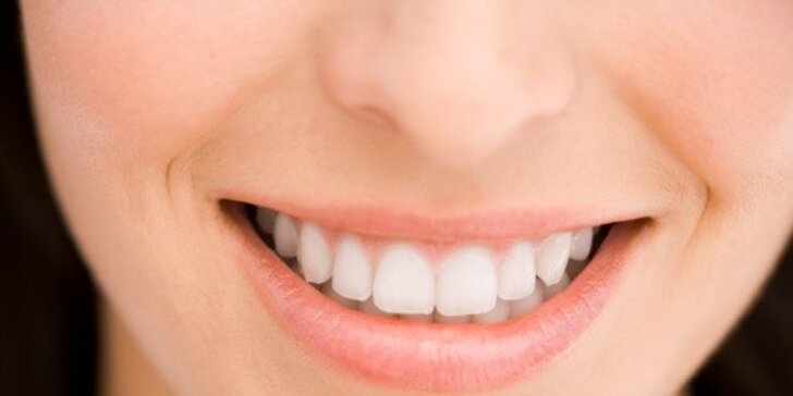 Dentální hygiena nebo ordinační bělení zubů 3v1