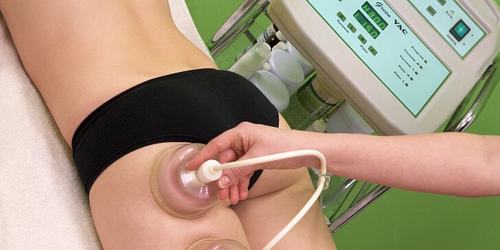 Vacupress: Baňková podtlaková 60minutová masáž s termozábalem