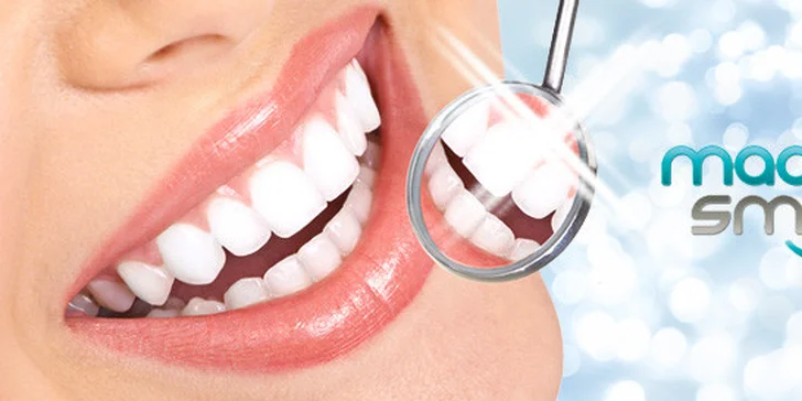 Komplexní dentální hygiena včetně Air Flow