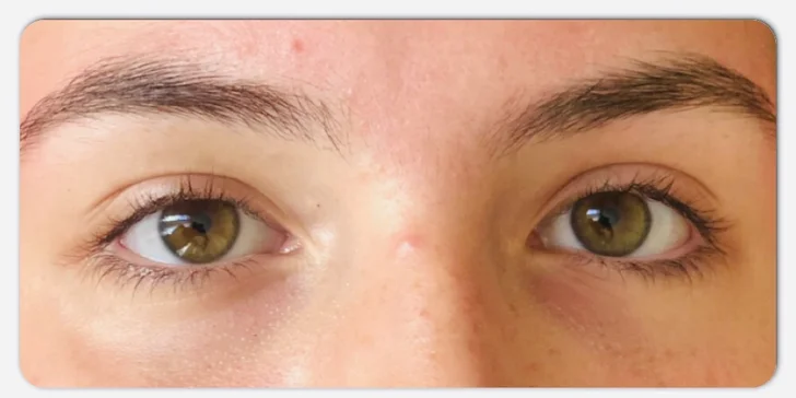 Lash lift pred a po aplikácii