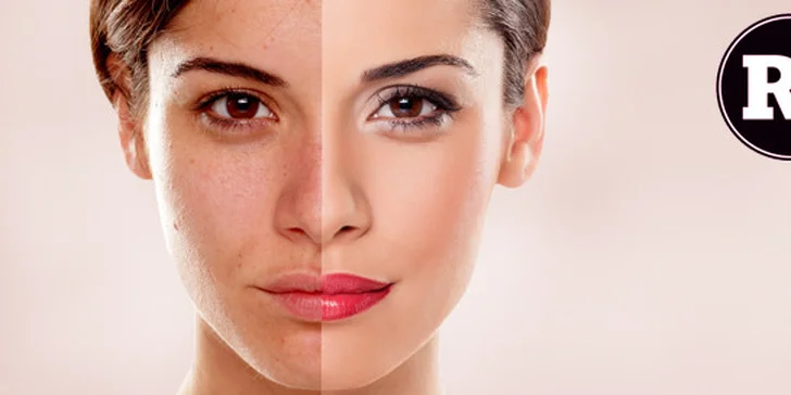 Chemický peeling včetně čištění pleti ultrazvukovou špachtlí