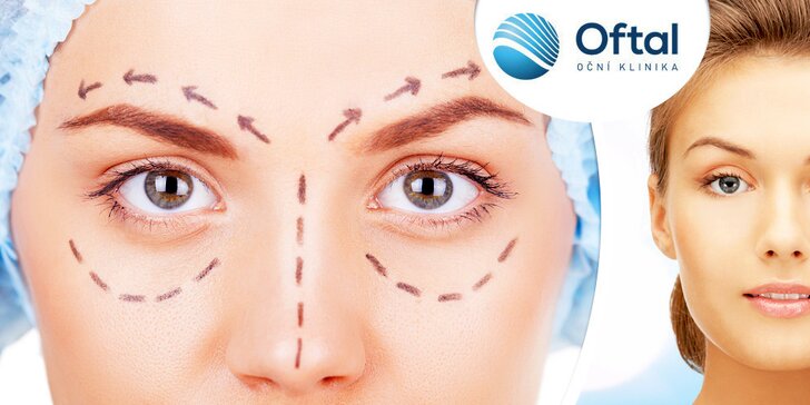Operace očních víček od specializovaného chirurga