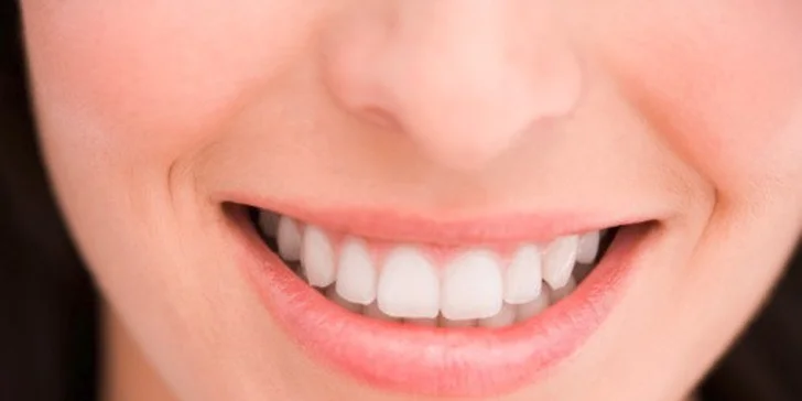 Dentální hygiena s air-flow v holešovické klinice