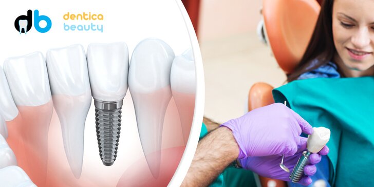 Vysoce kvalitní zubní implantát - metalokeramická korunka