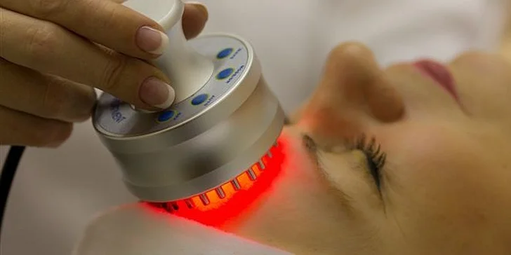 3D facelifting bez skalpelu - vypnutí obličeje, modelace podbradku s aplikací výtažku z lidských kmenových buněk