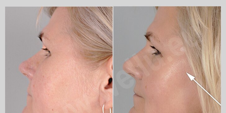 Omlazující a regenerační ošetření včetně masáže obličeje