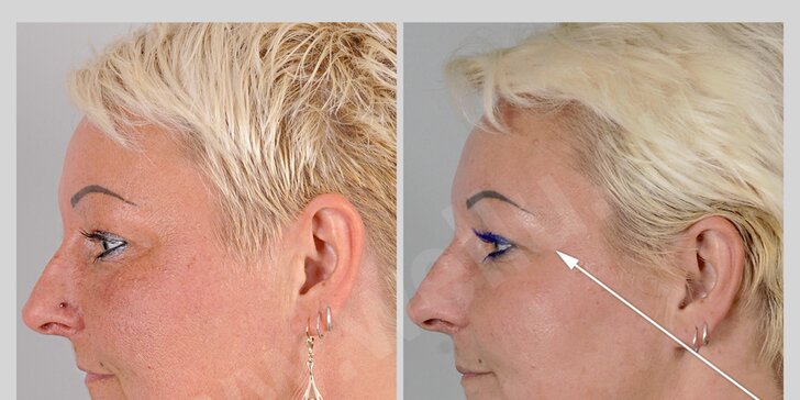 Omlazující a regenerační ošetření včetně masáže obličeje