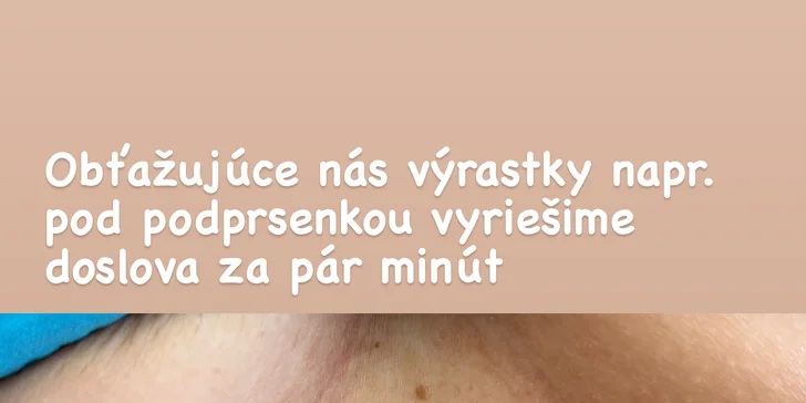 Výsledky ošetrení