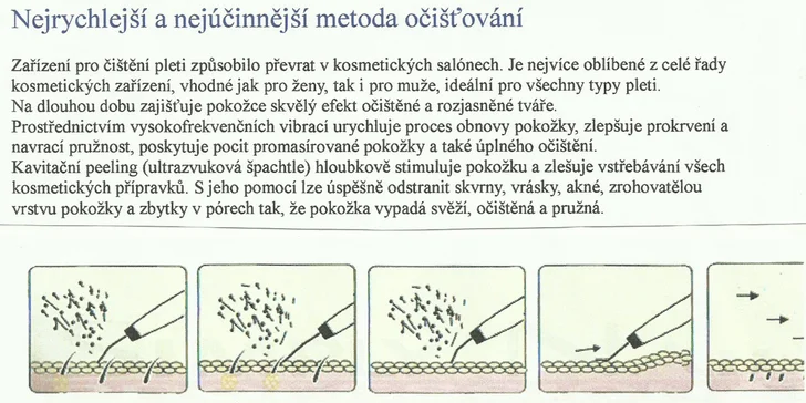 Ošetření pleti pomocí ultrazvukové špachtle