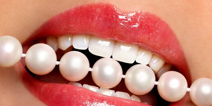 Laserové bělení zubů - Doctor Smile