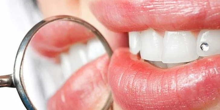 Dentální šperky - broušený křišťál do zubů
