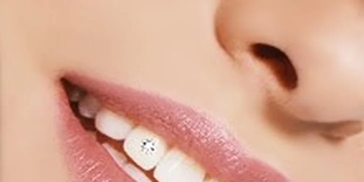 Dentální šperky - broušený křišťál do zubů
