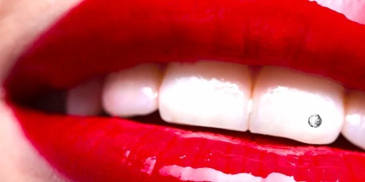 Dentální šperky - broušený křišťál do zubů