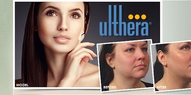 Ulthera - neinvazivní lifting obličeje a krku