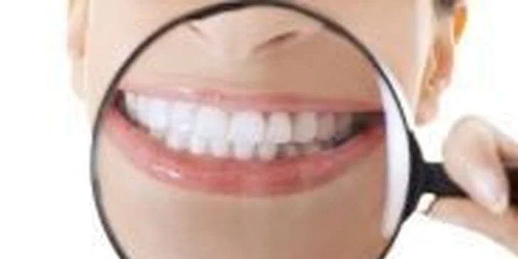 Bílá zubní výplň včetně kompletního vstupního vyšetření