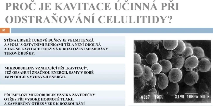 5 ošetření moderním ultrakavitačním přístrojem