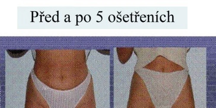 5 ošetření moderním ultrakavitačním přístrojem