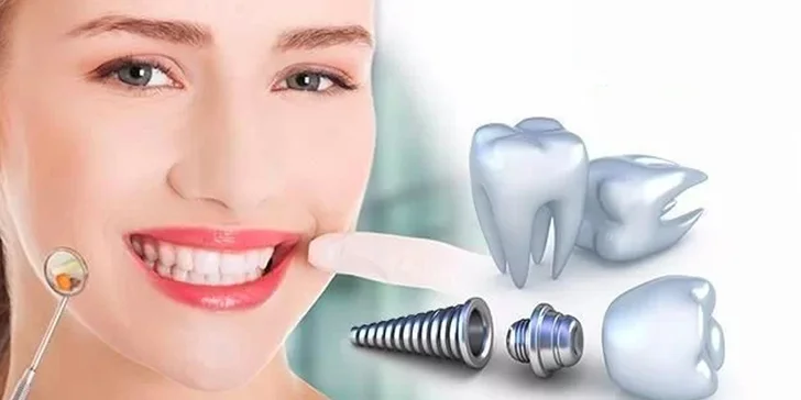 Zubní implantát Dentis - extra odolný