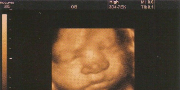 4D ultrazvuk vašeho miminka – záznam na CD či flashku
