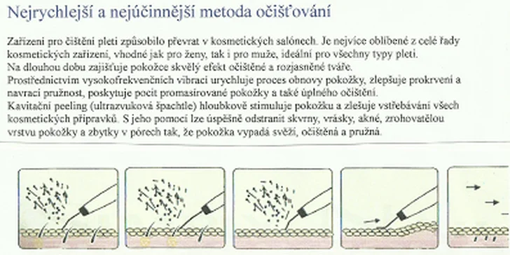 60minutové ultrazvukové čištění pleti
