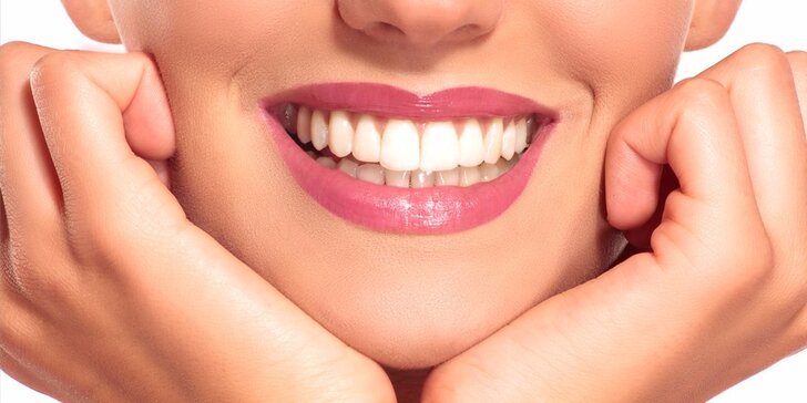 Ordinační bělení zubů