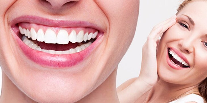 Bezperoxidové ordinační bělení zubů laserem pro zářivý úsměv
