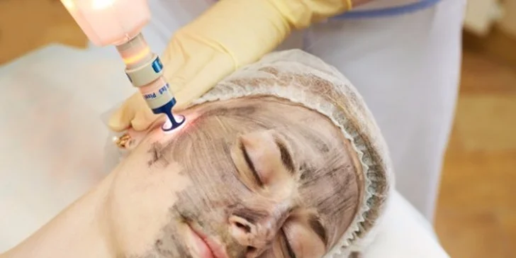 Karbonový laserový peeling pro problematickou pleť